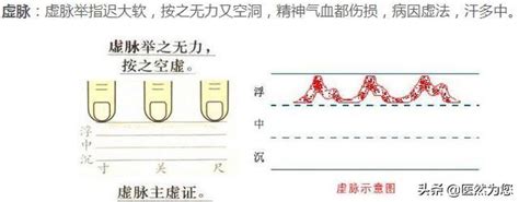 脈細數|脉细数